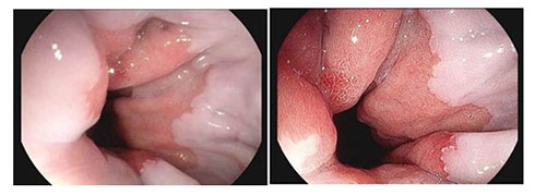 Công nghệ nội soi hiện đại tại Bệnh viện 22-12 Công nghệ nội soi hiện đại tại Bệnh viện 22-12