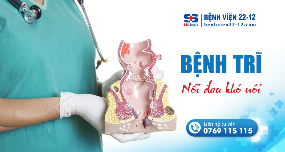 Bệnh viện 22-12 | Bệnh trĩ - Nỗi đau khó nói