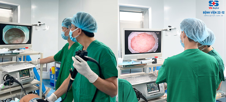 Nội soi cắt dưới niêm mạc dạ dày trong điều trị ung thư sớm (ESD) Nội soi cắt dưới niêm mạc dạ dày trong điều trị ung thư sớm (ESD)