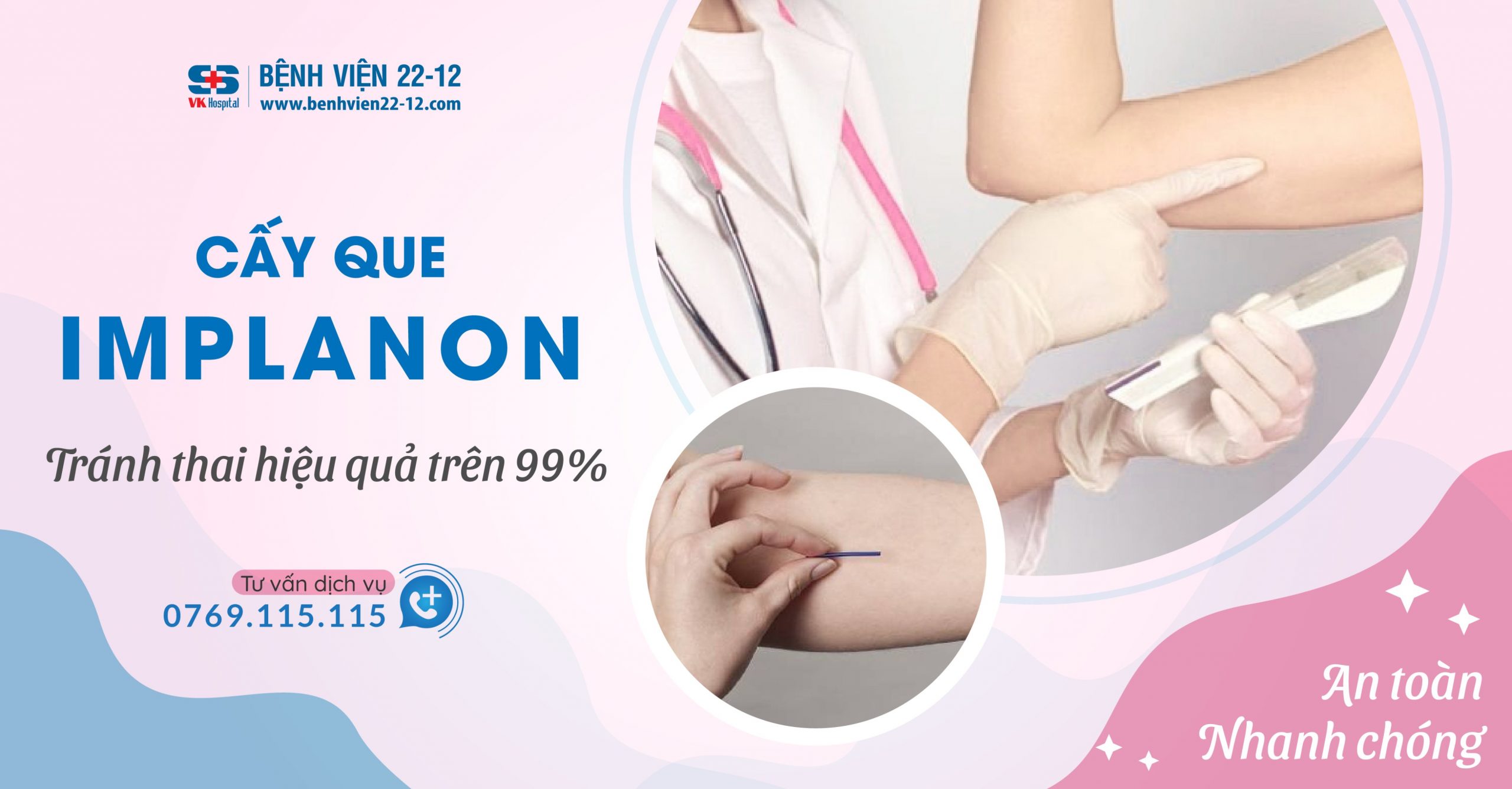 Bệnh viện 22-12 | Cấy que tránh thai an toàn