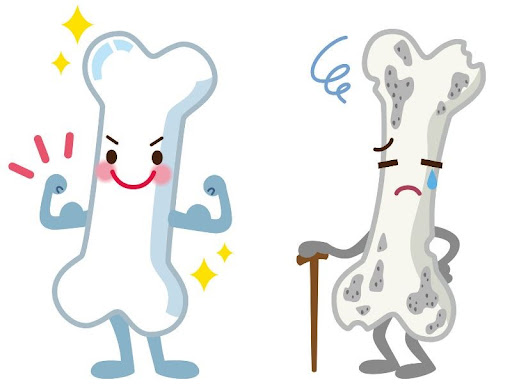 Bệnh viện 22-12 | Loãng xương là gì? Tầm quan trọng của việc tầm soát loãng xương