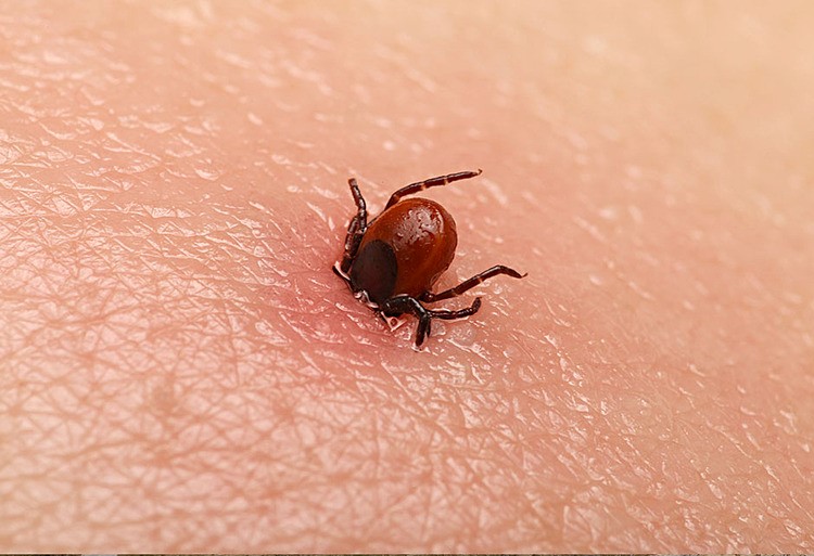 Bệnh viện 22-12 | Bệnh sốt mò - Những điều cần biết