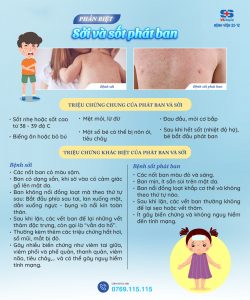 phân biệt sốt phát ban và sởi