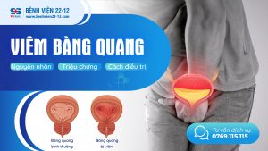 viêm bàng quang