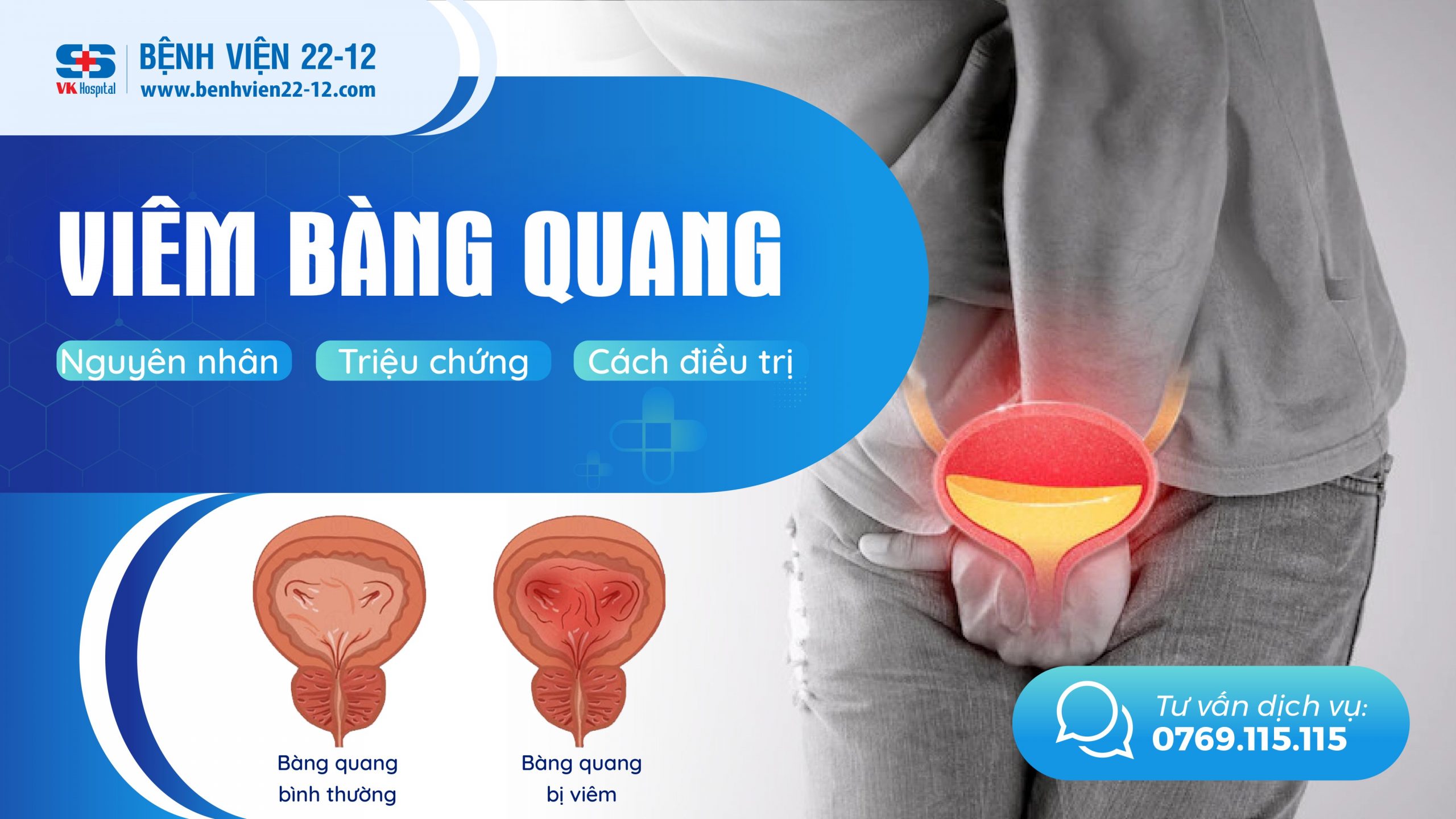 viêm bàng quang