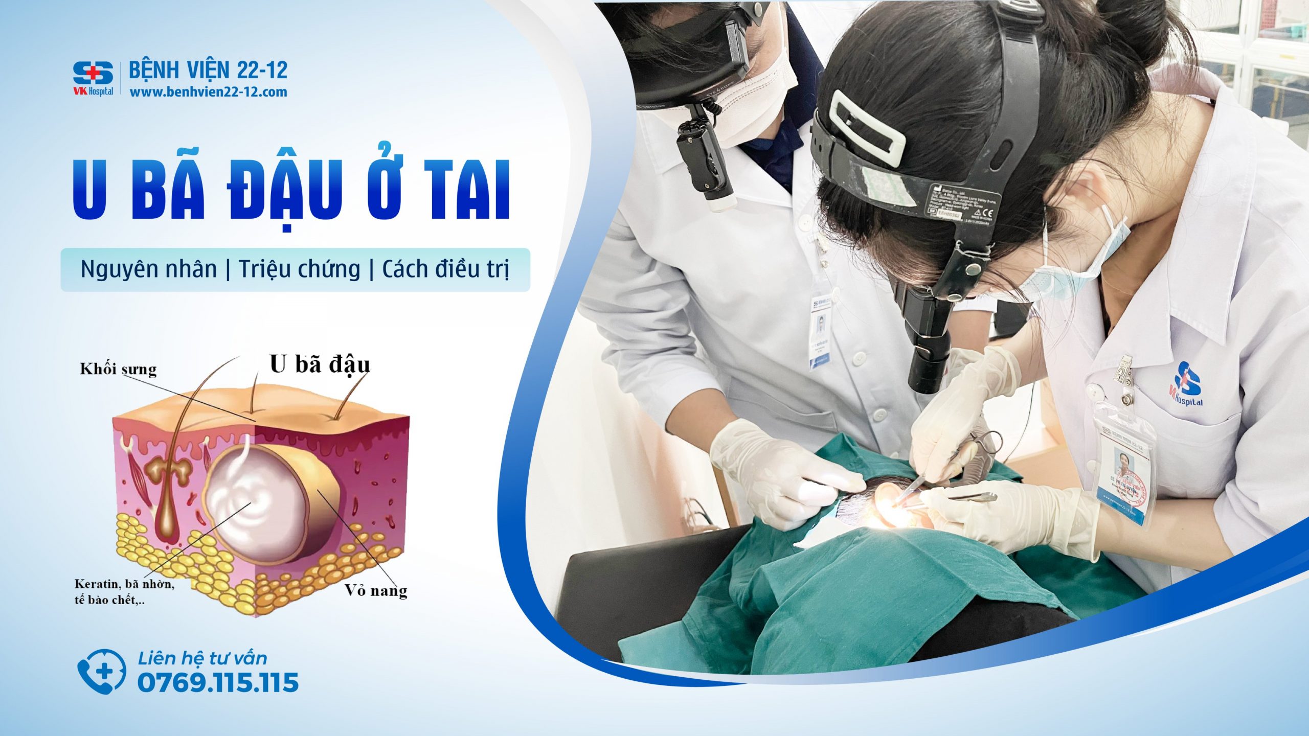 u bã đậu ở tai