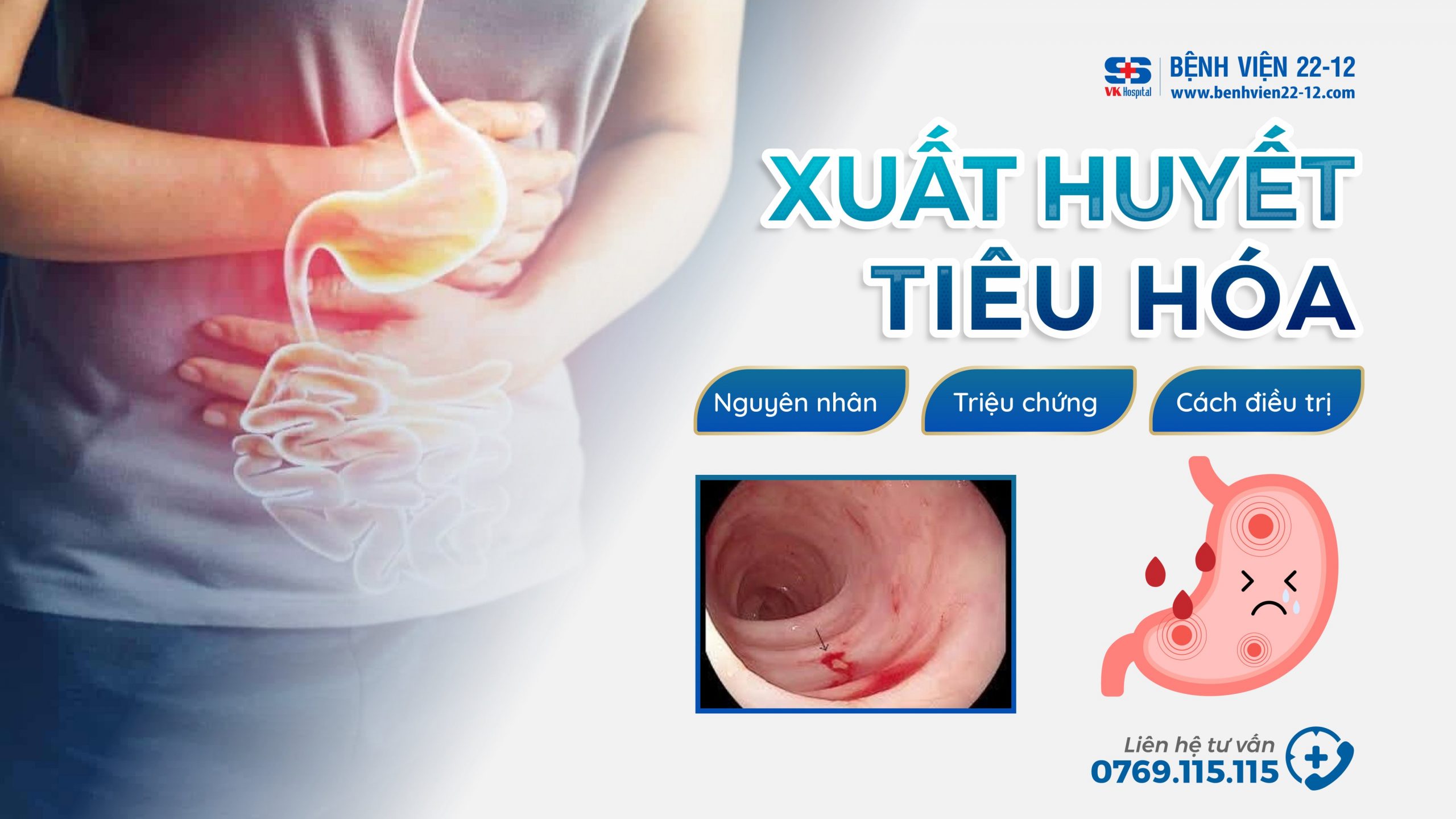 xuất huyết tiêu hóa