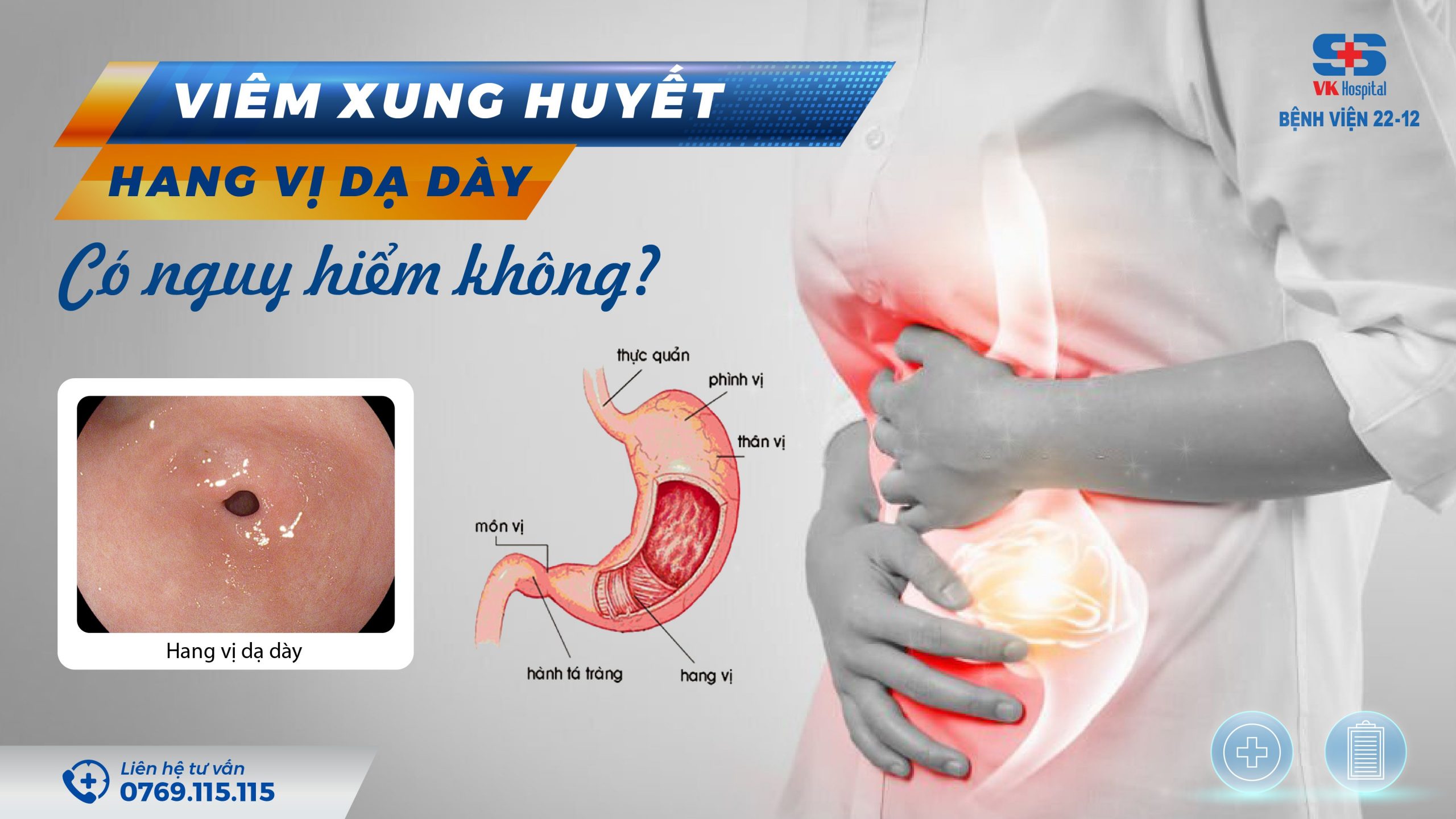 hang vị dạ dày