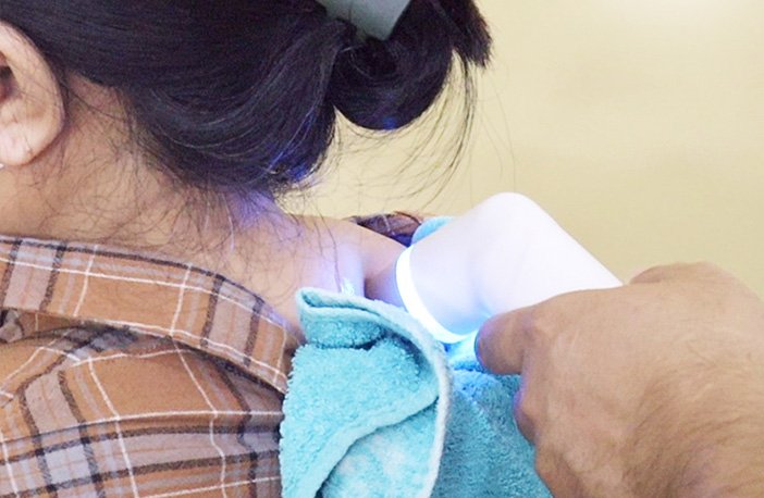 Bệnh viện 22-12 | Điều trị đau thần kinh sau zona điều trị đau thần kinh sau zona