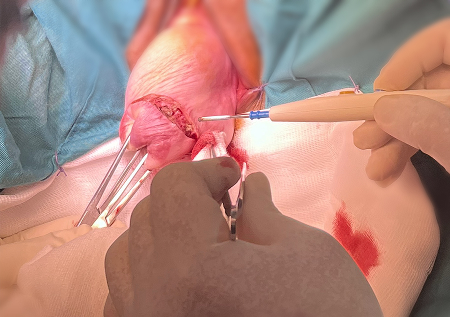 Bệnh viện 22-12 | Phẫu thuật sa sinh dục Bệnh viện 22-12 | Phẫu thuật sa sinh dục