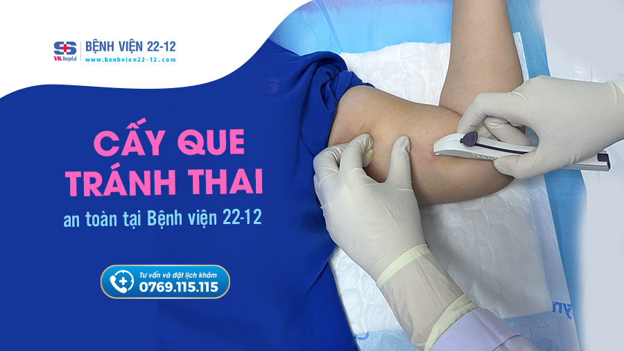 Bệnh viện 22-12 | Cấy que tránh thai Bệnh viện 22-12 | Cấy que tránh thai