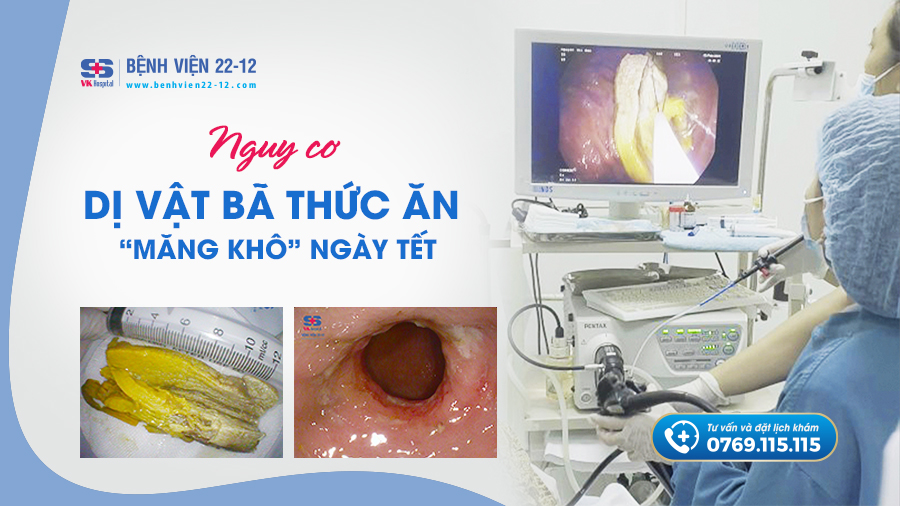 Bệnh viện 22-12 | Nguy cơ dị vật bã thức ăn "măng khô" ngày Tết