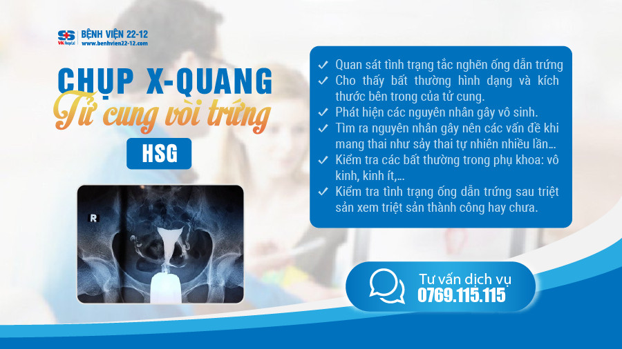 Bệnh viện 22-12 | Chụp x-quang tử cung vòi trứng Bệnh viện 22-12 | Chụp x-quang tử cung vòi trứng