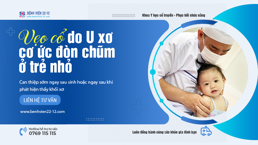 Bệnh viện 22-12 | Vẹo cổ do u xơ cơ ức đòn chũm ở trẻ