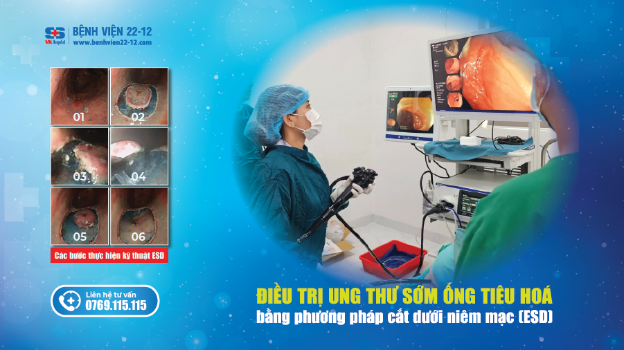 Bệnh viện 22-12 | Điều trị ung thư sớm ống tiêu hóa bằng phương pháp cắt dưới niêm mạc ESD Bệnh viện 22-12 | Điều trị ung thư sớm ống tiêu hóa bằng phương pháp cắt dưới niêm mạc ESD