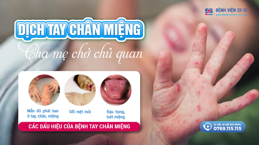 Bệnh viện 22-12 | Dịch tay chân miệng Bệnh viện 22-12 | Dịch tay chân miệng