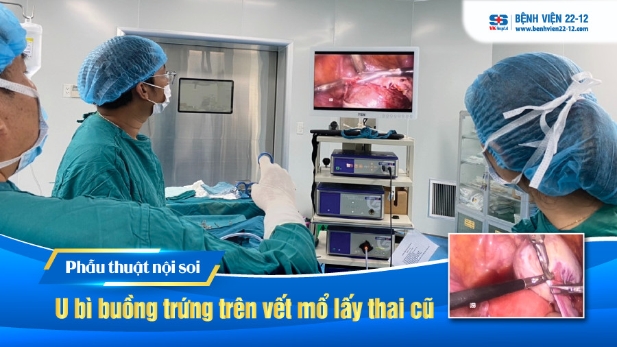 Bệnh viện 22-12 | U bì buồng trứng trên vết mổ lấy thai cũ Bệnh viện 22-12 | U bì buồng trứng trên vết mổ lấy thai cũ