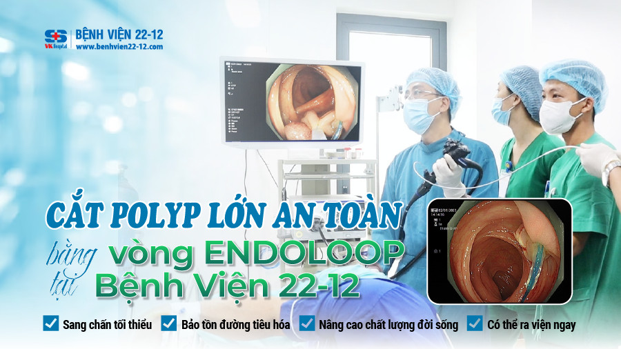 Bệnh viện 22-12/cắt polyp lớn bằng vòng endoloop Bệnh viện 22-12/cắt polyp lớn bằng vòng endoloop