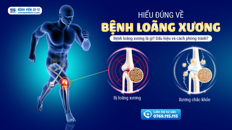bệnh viện 22-12/hiểu đúng về bệnh loãng xương bệnh viện 22-12/hiểu đúng về bệnh loãng xương
