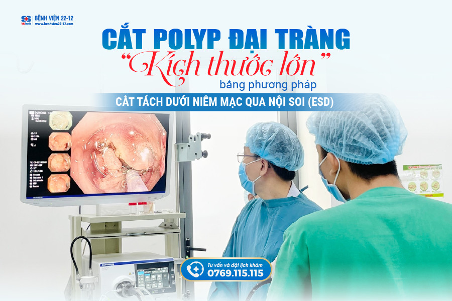 Bệnh viện 22-12/cắt polyp đại tràng bằng phương pháp ESD Bệnh viện 22-12/cắt polyp đại tràng bằng phương pháp ESD
