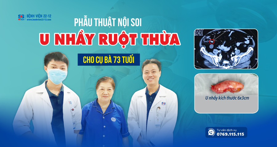 Bệnh viện 22-12 | Phẫu thuật thành công u nhầy ruột thừa bằng phương pháp phẫu thuật nội soi Bệnh viện 22-12 | Phẫu thuật thành công u nhầy ruột thừa bằng phương pháp phẫu thuật nội soi