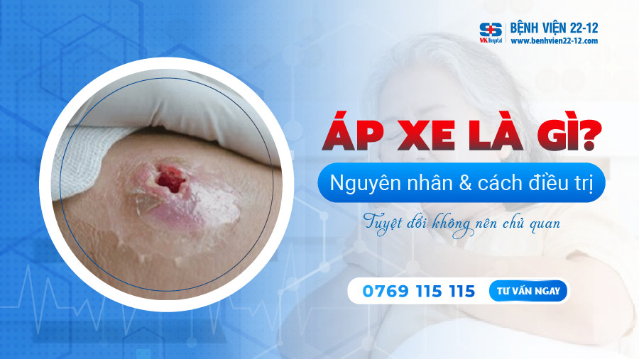Bệnh viện 22-12 | Bệnh áp xe Bệnh viện 22-12 | Bệnh áp xe