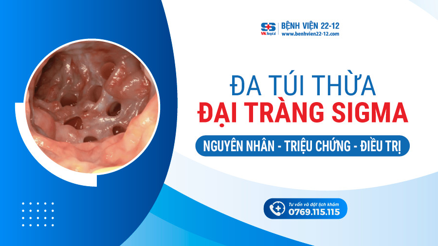 Bệnh viện 22-12 | Đa túi thừa đại tràng sigma Bệnh viện 22-12 | Đa túi thừa đại tràng sigma