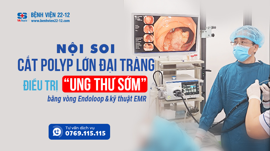 benh vien 22-12/noi soi cat polyp lon dai trang benh vien 22-12/noi soi cat polyp lon dai trang
