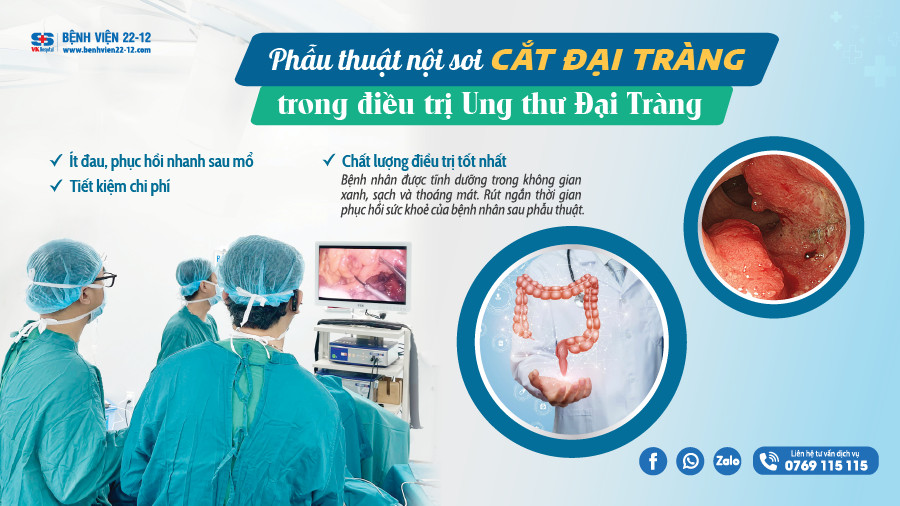 benh vien 22-12/phau thuat noi soi cat dai trang trong dieu tri ung thu dai trang benh vien 22-12/phau thuat noi soi cat dai trang trong dieu tri ung thu dai trang