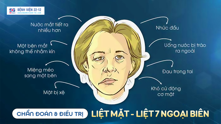 Benh vien 22-12 | Liet mat liet vii ngoai bien Benh vien 22-12 | Liet mat liet vii ngoai bien