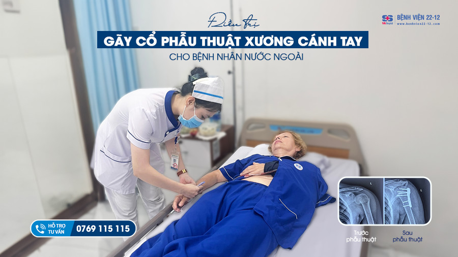 Bệnh viện 22-12 | Điều trị gãy cổ phẫu thuật xương cánh tay Bệnh viện 22-12 | Điều trị gãy cổ phẫu thuật xương cánh tay