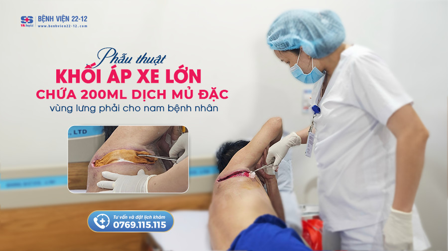 Bệnh viện 22-12 | Phẫu thuật ap xe vùng lưng phải cho bệnh nhân