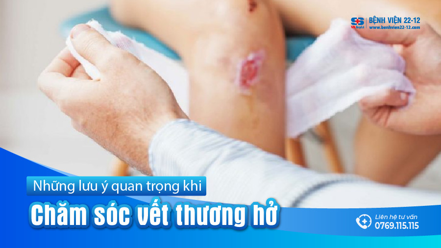 Benh vien 22-12 | Cham soc vet thuong ho