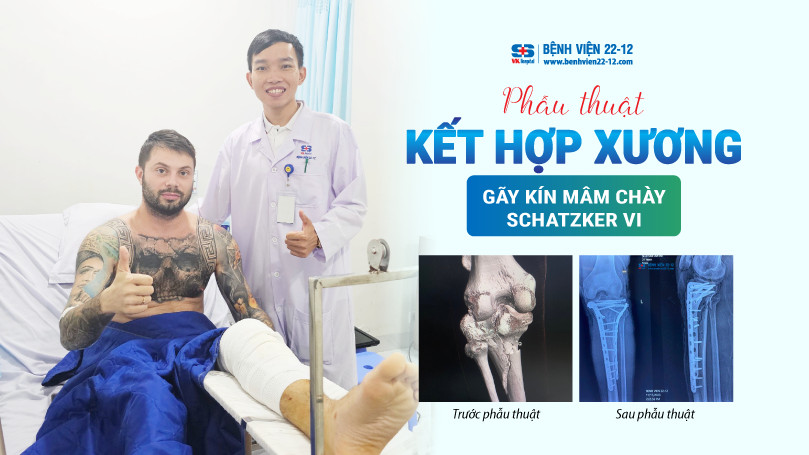 Benh vien 22-12 | Phau thuat ket hop xuong gay kin mam chay Schatzker VI Benh vien 22-12 | Phau thuat ket hop xuong gay kin mam chay Schatzker VI