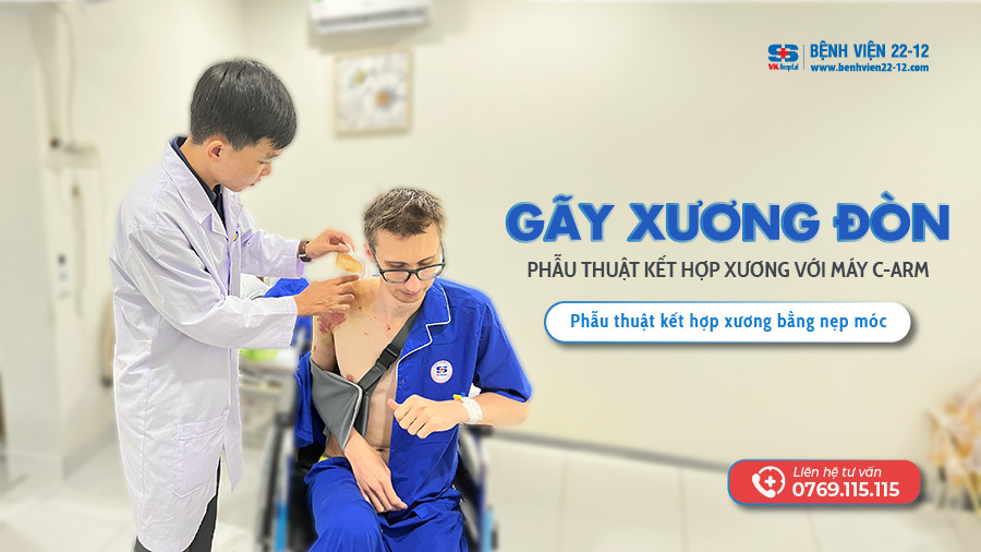 Bệnh viện 22-12 | Phẫu thuật gãy xương đòn