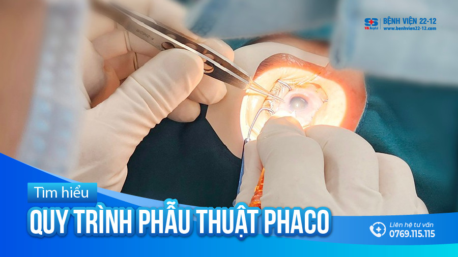 Bệnh viện 22-12 | Quy trình phẫu thuật Phaco Bệnh viện 22-12 | Quy trình phẫu thuật Phaco