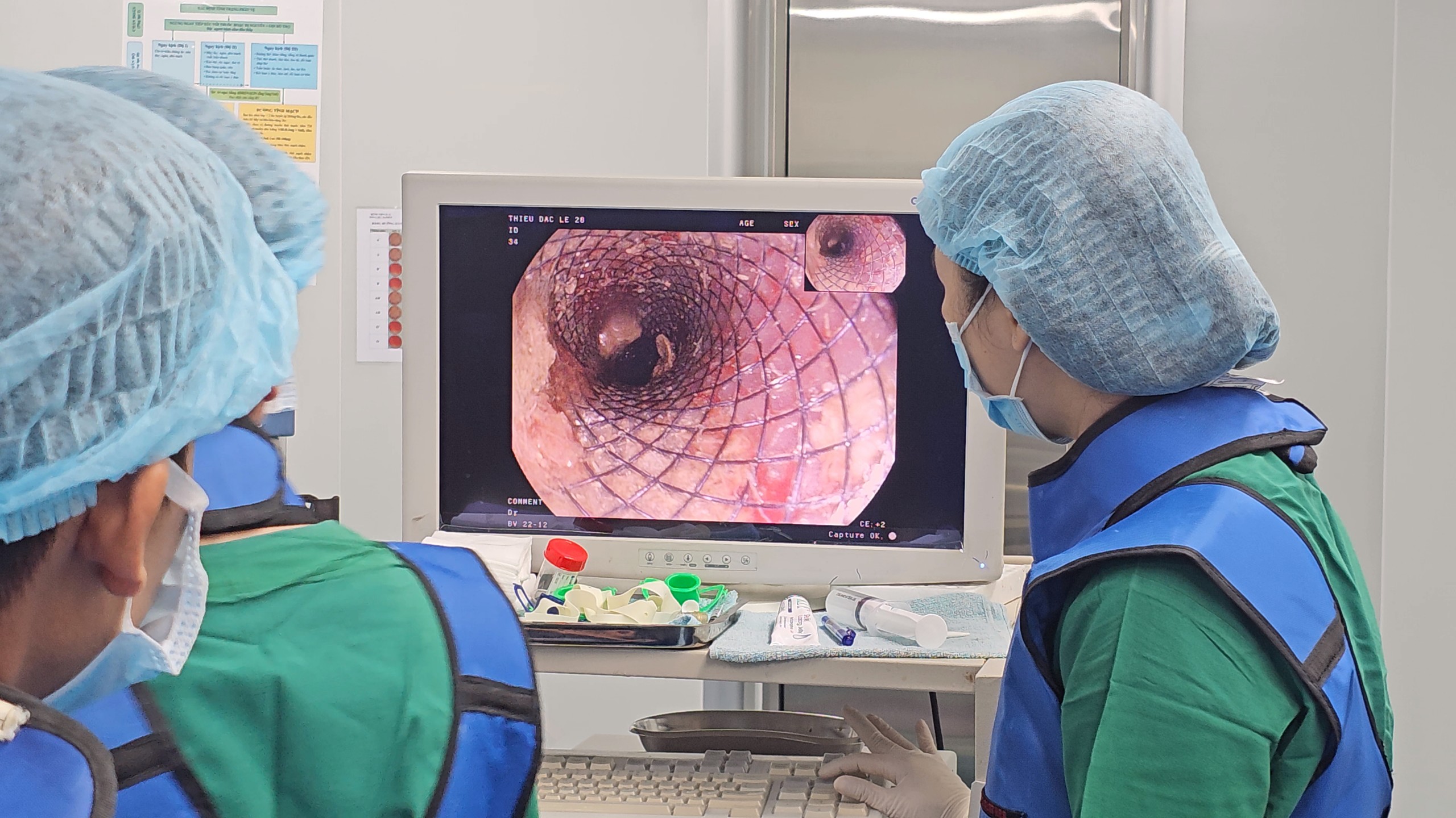 Bệnh viện 22-12: Can thiệp đặt stent cho bệnh nhân ung thư thực quản Bệnh viện 22-12: Can thiệp đặt stent cho bệnh nhân ung thư thực quản