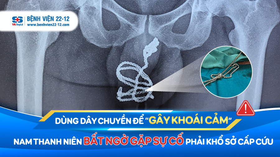 Bệnh viện 22-12 | Dùng dây chuyền gây khoái cảm, nam thanh niên gặp sự cố Bệnh viện 22-12 | Dùng dây chuyền gây khoái cảm, nam thanh niên gặp sự cố