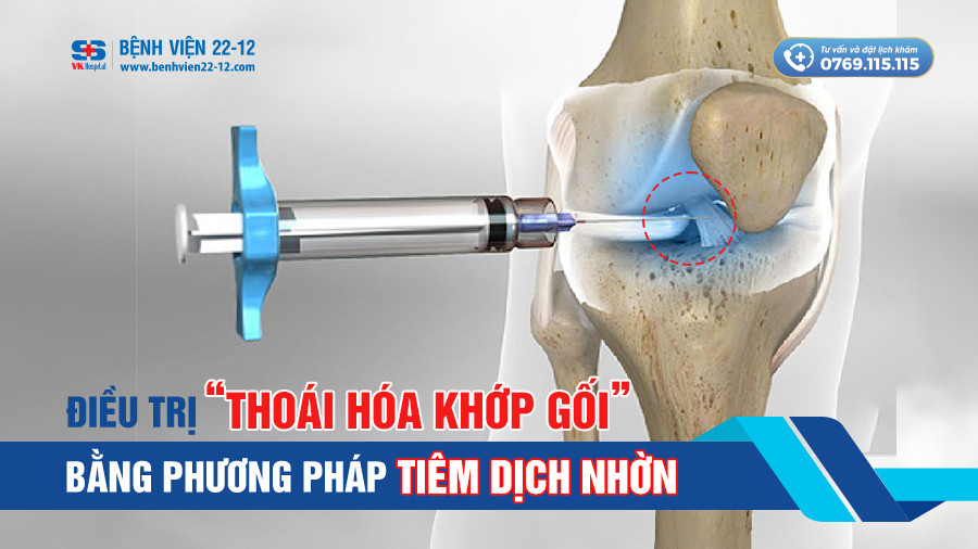 Bệnh viện 22-12 | Điều trị thoái hóa khớp gối bằng phương pháp tiêm chất nhờn Bệnh viện 22-12 | Điều trị thoái hóa khớp gối bằng phương pháp tiêm chất nhờn