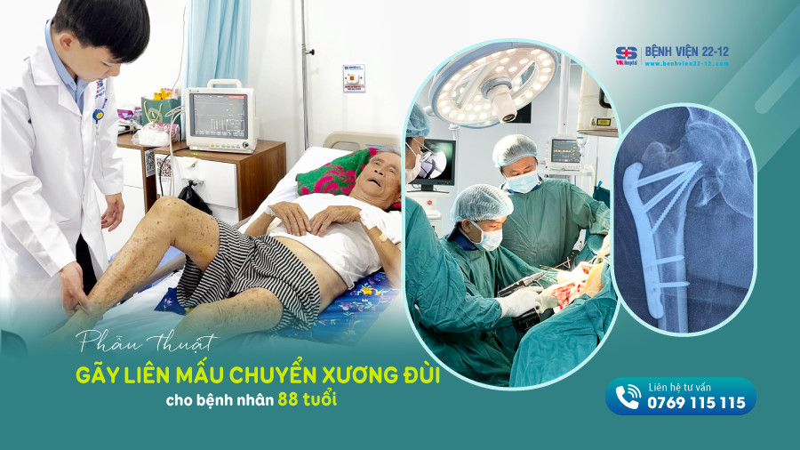Bệnh viện 22-12 | Phẫu thuật thành công bệnh nhân 88 tuổi gãy liên mấu chuyển xương đùi Bệnh viện 22-12 | Phẫu thuật thành công bệnh nhân 88 tuổi gãy liên mấu chuyển xương đùi
