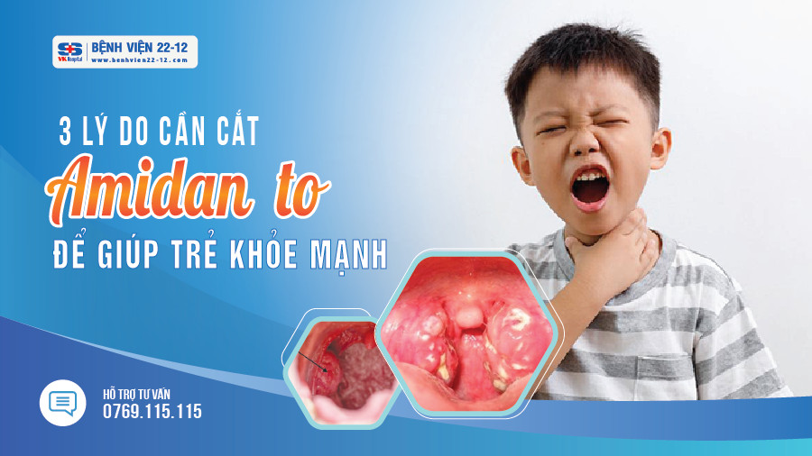 Bệnh viện 22-12 | Cắt amidan to giúp trẻ khỏe-mạnh Bệnh viện 22-12 | Cắt amidan to giúp trẻ khỏe-mạnh
