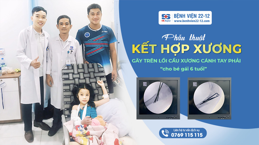 Bệnh viện 22-12 | Phẫu thuật kết hợp xương gãy trên lồi cầu xương cánh tay phải cho bé gái 6 tuổi Bệnh viện 22-12 | Phẫu thuật kết hợp xương gãy trên lồi cầu xương cánh tay phải cho bé gái 6 tuổi