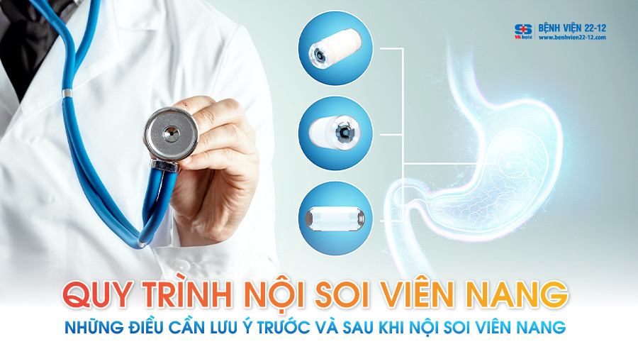 Bệnh viện 22-12 | Quy trình nội soi viên nang Bệnh viện 22-12 | Quy trình nội soi viên nang