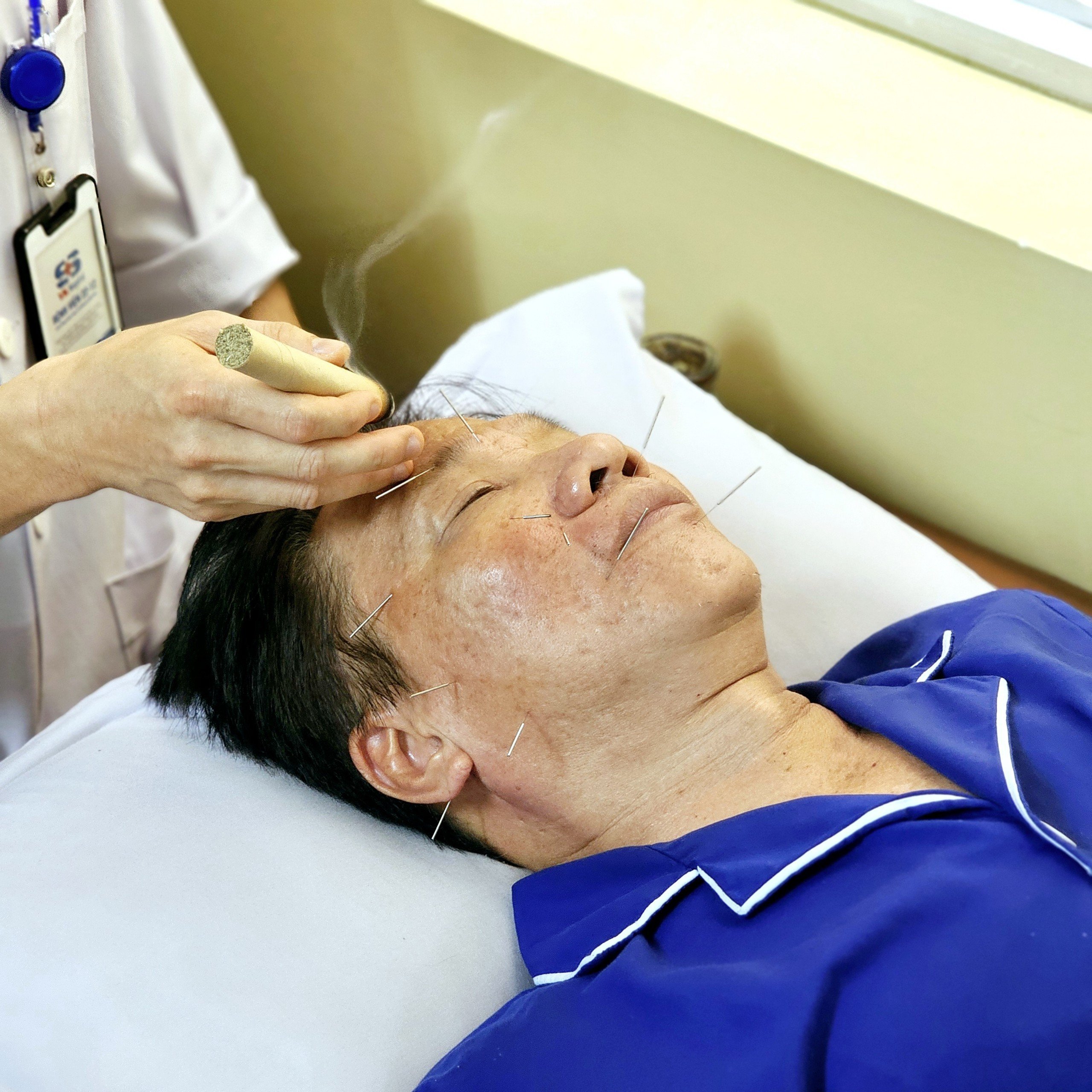 Bệnh viện 22-12 | Nguy cơ méo miệng, liệt mặt do thay đổi thời tiết đột ngột Bệnh viện 22-12 | Nguy cơ méo miệng, liệt mặt do thay đổi thời tiết đột ngột