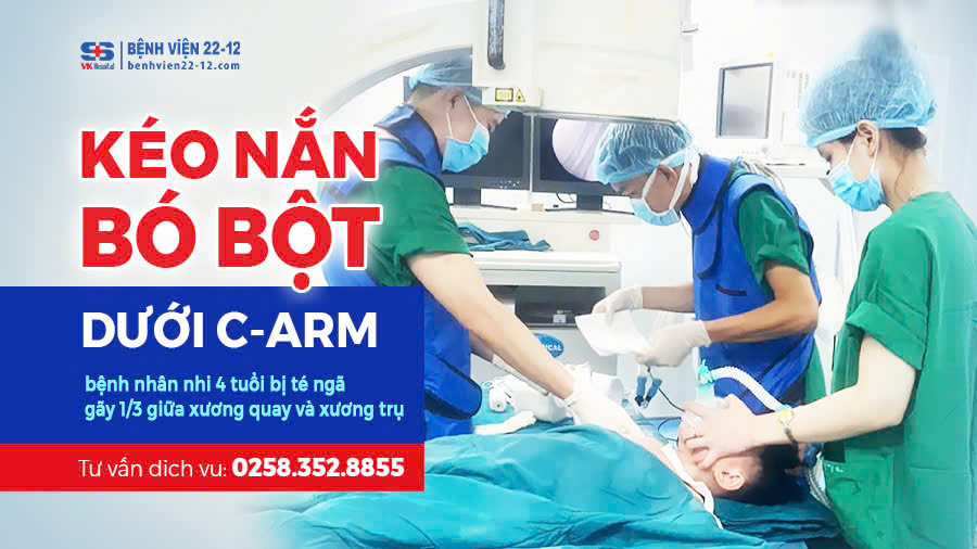 Bệnh viện 22-12 | Kéo nắn bó bột dưới màn hình tăng sáng Thành công cho bệnh nhi gãy 1/3 giữa xương quay và xương trụ Bệnh viện 22-12 | Kéo nắn bó bột dưới màn hình tăng sáng Thành công cho bệnh nhi gãy 1/3 giữa xương quay và xương trụ