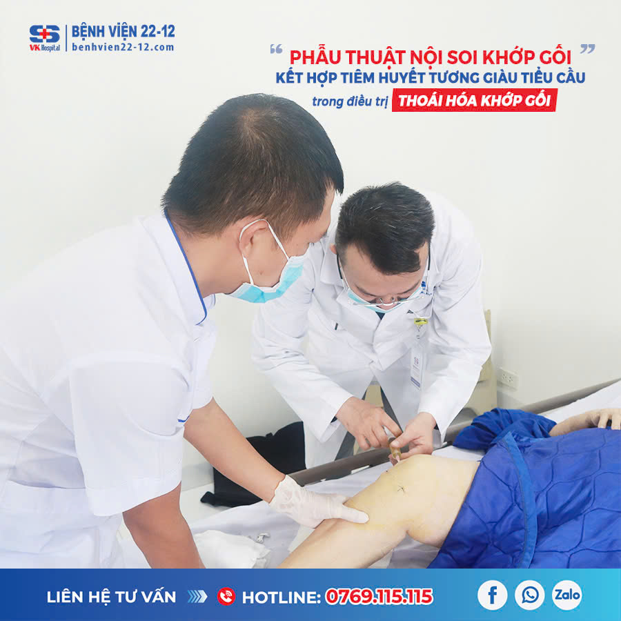 Bệnh viện 22-12 áp dụng phẫu thuật nội soi khớp gối kết hợp tiêm huyết tương giàu tiểu cầu trong điều trị thoái hóa khớp gối Bệnh viện 22-12 áp dụng phẫu thuật nội soi khớp gối kết hợp tiêm huyết tương giàu tiểu cầu trong điều trị thoái hóa khớp gối