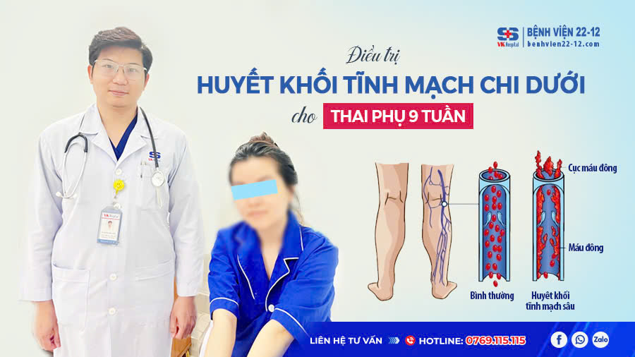 Bệnh viện 22-12 | Điều trị huyết khối tĩnh mạch chi dưới cho thai phụ