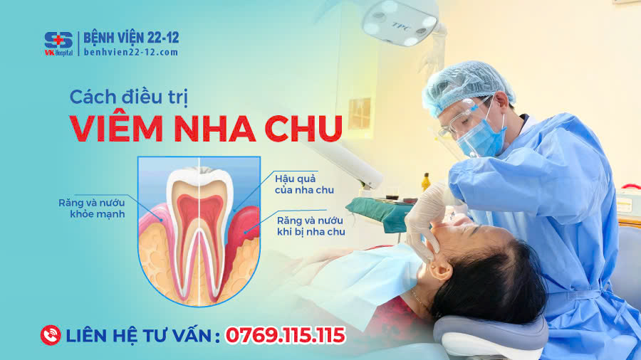 Bệnh viện 22-12 | Viêm nha chu và cách điều trị Bệnh viện 22-12 | Viêm nha chu và cách điều trị