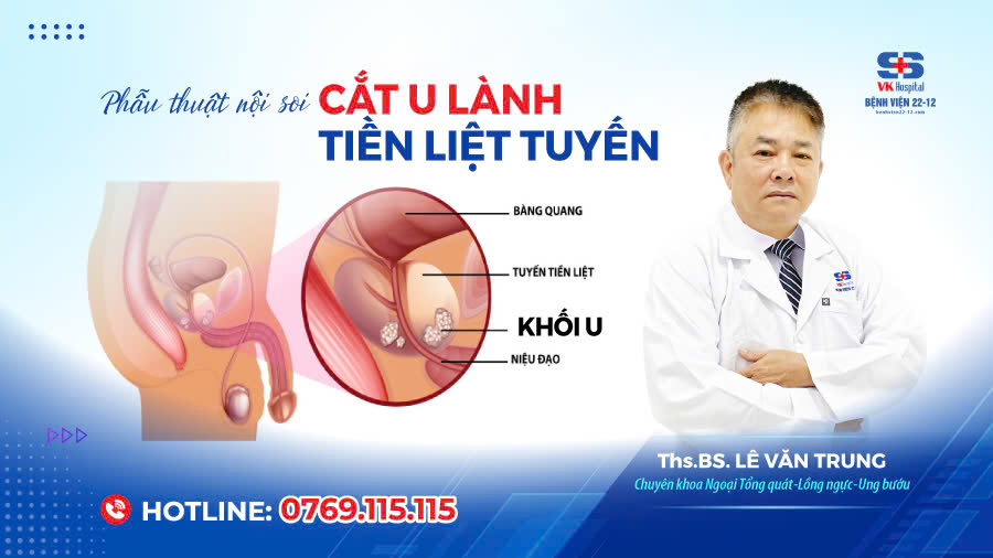 Bệnh viện 22-12 | Phẫu thuật nội soi cắt u lành tiền liệt tuyến Bệnh viện 22-12 | Phẫu thuật nội soi cắt u lành tiền liệt tuyến