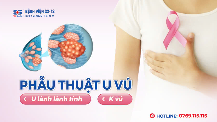 Bệnh viện 22-12 | Phẫu thuật u vú - An toàn và thẩm mỹ cùng Ths.BS Lê Văn Trung Bệnh viện 22-12 | Phẫu thuật u vú - An toàn và thẩm mỹ cùng Ths.BS Lê Văn Trung